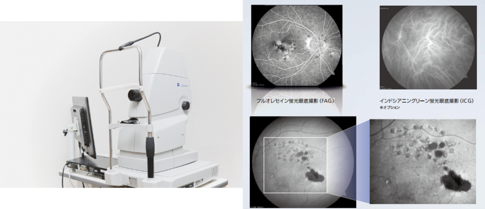 網膜・黄斑疾患の検査｜寝屋川市 たおもと大浦アイクリニック
